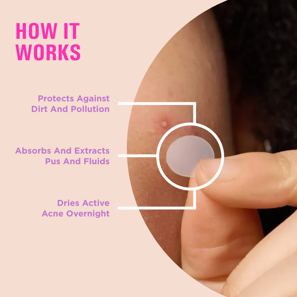 Acne Pimple Patch - 72 Dots