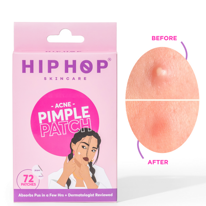 Acne Pimple Patch - 72 Dots